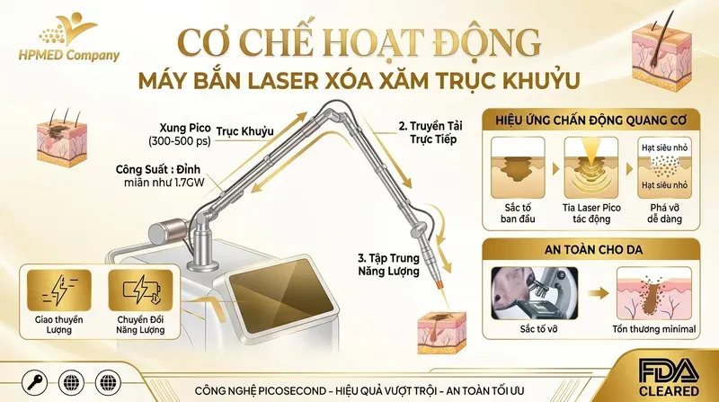 Cơ chế hoạt động của máy bắn laser xóa xăm trục khuỷu